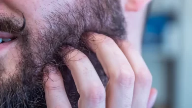 Barbe prurigineuse : 6 causes possibles