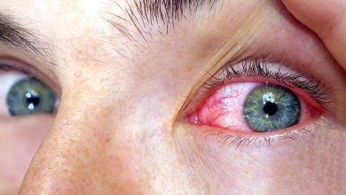 Understanding Eye Diseases: Types, Symptoms and Prevention
