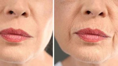 Comment faire disparaître les rides autour des lèvres ?