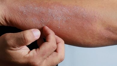 Posthite : Causes symptômes et traitements 