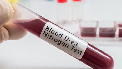 Urée sanguine : connaître le taux normal et son importance dans les analyses