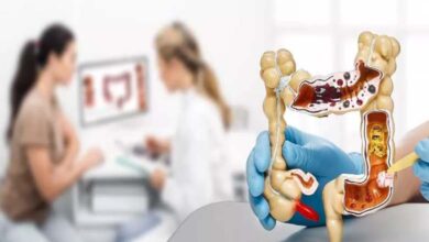 Médicament abordable : Bonne nouvelle pour les patients atteints du syndrome de l'intestin irritable 