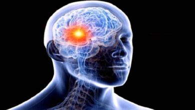 Développement d'un test de détection du cancer du cerveau... Le premier et le plus rapide au monde 