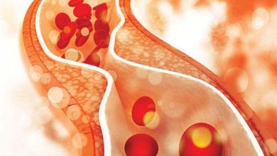 Rigidité artérielle chez les jeunes : une étude révèle les causes et les risques