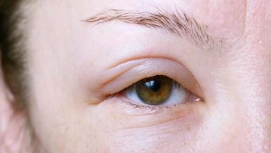 Gonflement des yeux en hiver... Comment y faire face ?