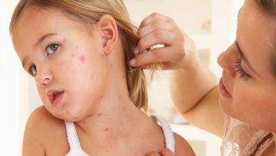 Propagation de la rougeole à Gaza... Est-ce que cela devient une épidémie ? 