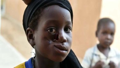 "Noma" mangeur de bouche... La maladie grave négligée ! 