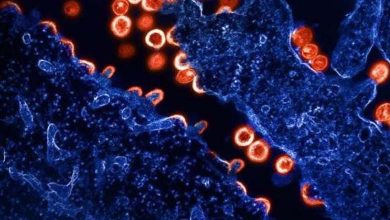 Nouvel espoir pour les patients atteints du SIDA : Efficacité d'anticorps luttant contre le virus 