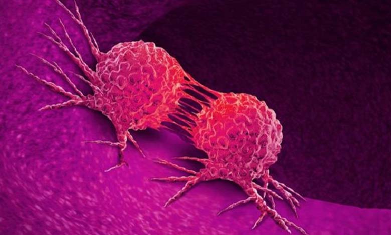 Quatre facteurs derrière une hausse "Préoccupante" des nouveaux cas de cancer 