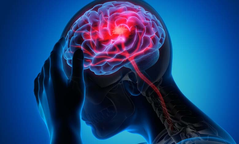‘Symptômes’ inhabituels d'un accident vasculaire cérébral