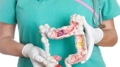 5 Principes pour Réduire le Risque de Cancer du Côlon