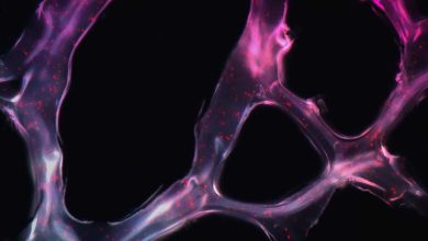 L'or, un traitement efficace pour les patients atteints de sclérose en plaques