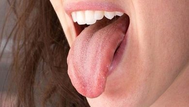 La couleur de votre langue peut révéler votre état de santé