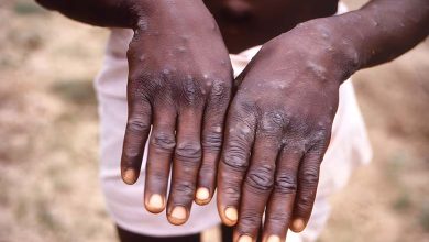 "La variole du singe" impose un état d'urgence sanitaire en Afrique