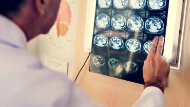 Un traitement génique potentiel pour l'épilepsie montre des résultats prometteurs lors des essais en laboratoire