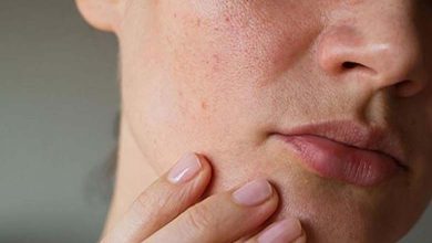 À l'approche de l'hiver… 5 conseils pour traiter la peau sèche