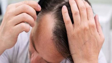 Découverte « surprenante » d’un traitement contre la perte de cheveux et la calvitie héréditaire