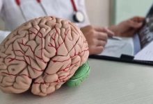 3 symptômes d’alerte – Comment détecter un AVC en quelques minutes ?