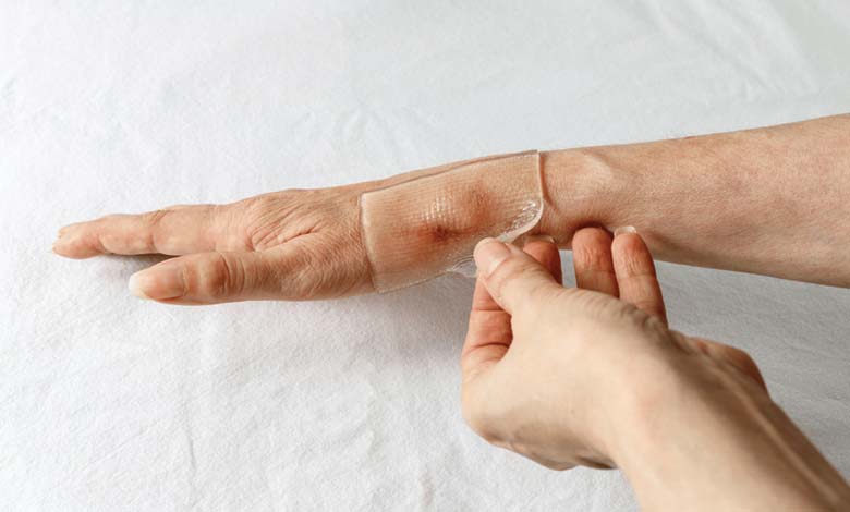 Le pansement en silicone est-il vraiment efficace pour traiter les cicatrices ?