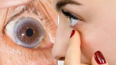 Les symptômes d’un taux élevé de cholestérol peuvent apparaître dans un seul œil