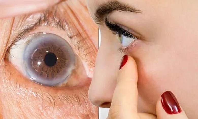 Les symptômes d’un taux élevé de cholestérol peuvent apparaître dans un seul œil