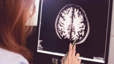 La perte de cholestérol dans le cerveau : première étincelle possible de la maladie d’Alzheimer