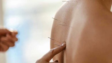 L’acupuncture : un traitement efficace ou une simple illusion ?