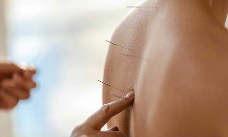L’acupuncture : un traitement efficace ou une simple illusion ?
