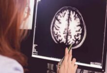 Comment le cholestérol cérébral influence la mémoire et l’apprentissage ?