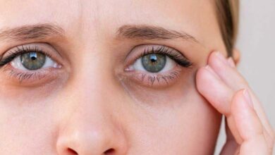 Comment le déficit en vitamines influence la formation des cernes sous les yeux