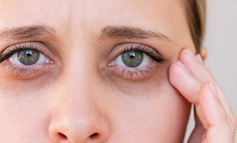 Comment le déficit en vitamines influence la formation des cernes sous les yeux