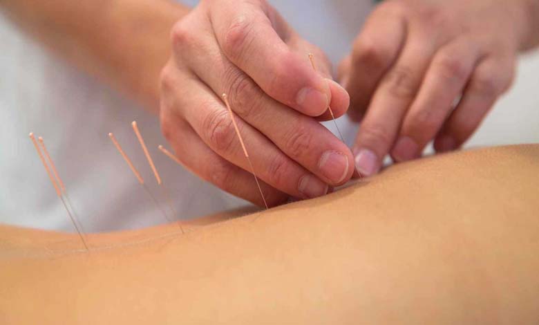 L’acupuncture : résultats efficaces ou simple publicité trompeuse ?