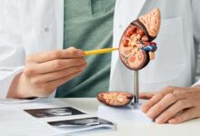 Remèdes maison ou traitements médicaux : quelle approche privilégier pour les calculs rénaux ?