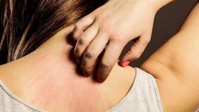 La démangeaison cutanée : un signal précoce possible d’une maladie rénale