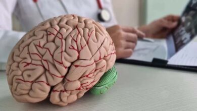 Signes précoces pouvant avertir d’un accident vasculaire cérébral un mois avant son apparition