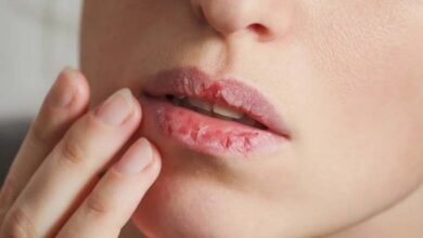 Lèvres pâles et ongles cassants : des signes visibles pouvant révéler un trouble de santé caché