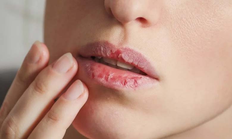 Lèvres pâles et ongles cassants : des signes visibles pouvant révéler un trouble de santé caché