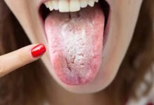 L’intelligence artificielle diagnostique certaines maladies grâce à l’analyse de la langue