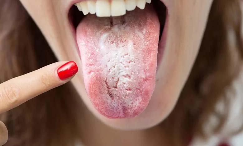 L’intelligence artificielle diagnostique certaines maladies grâce à l’analyse de la langue