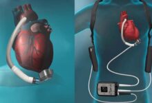 Un cœur artificiel pour tester les médicaments sans risque pour l’être humain