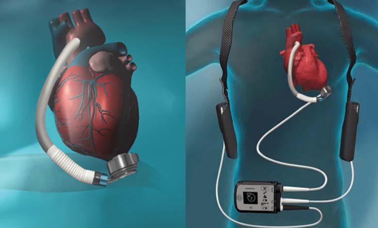 Un cœur artificiel pour tester les médicaments sans risque pour l’être humain