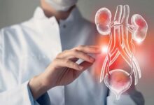 Les infections urinaires sévères et leur rôle potentiel dans l’augmentation du risque de démence