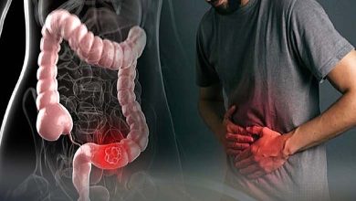 Que se passe-t-il dans l’intestin lors d’une crise de syndrome de l’intestin irritable ? Analyse des mécanismes physiologiques et neurobiologiques