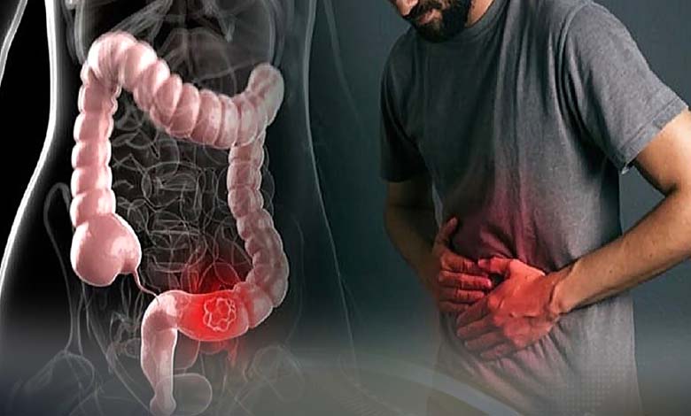 Que se passe-t-il dans l’intestin lors d’une crise de syndrome de l’intestin irritable ? Analyse des mécanismes physiologiques et neurobiologiques