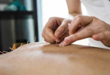 L’acupuncture comme alternative plus sûre : quel rôle dans la lutte contre la crise des opioïdes ?