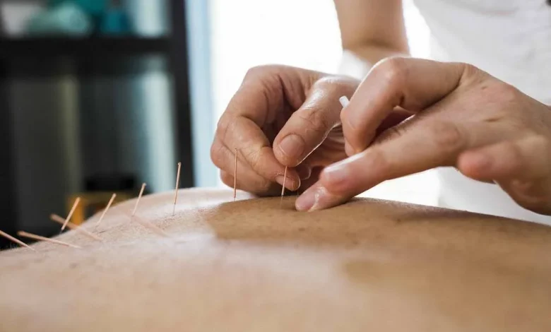L’acupuncture comme alternative plus sûre : quel rôle dans la lutte contre la crise des opioïdes ?