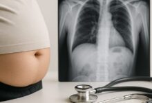 Une étude suggère que la graisse abdominale pourrait augmenter le risque de cancer du poumon