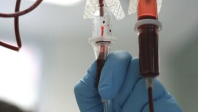 La maladie d’Alzheimer peut-elle se transmettre par le sang ?