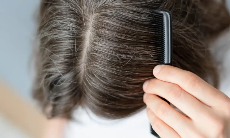 Pourquoi la texture des cheveux change-t-elle avec l'âge ?