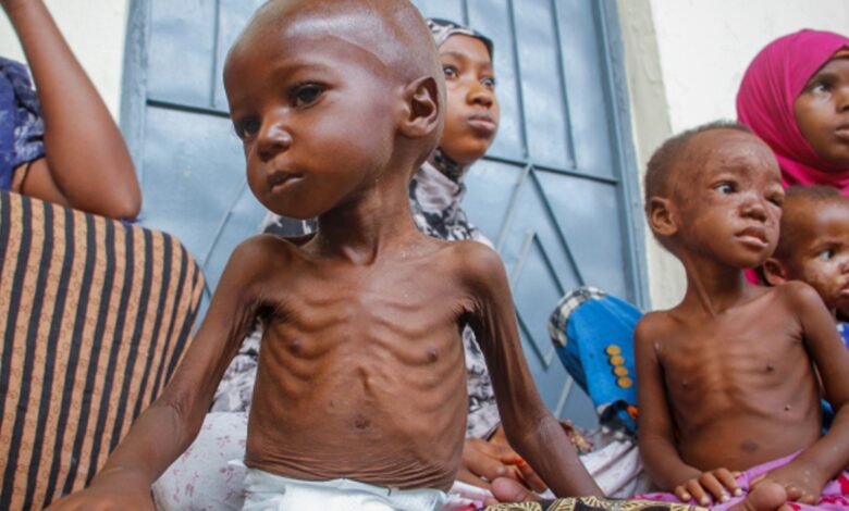 La faim comme arme dans les centres de détention : des corps décharnés, témoins d’une extermination silencieuse